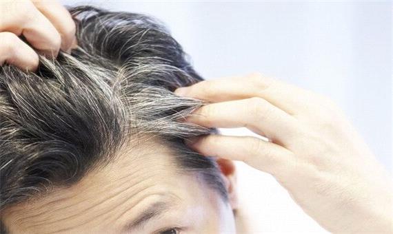 عواملی که باعث سفیدی زودرس موها می‌شود