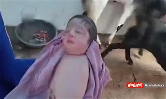 به دنیا آمدن نوزاد بی دست و پا در هند!