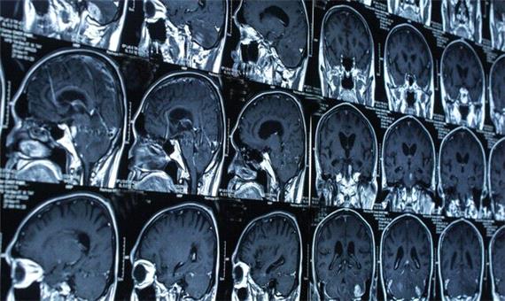 ارائه آخرین یافته‌ها درباره مغز از سوی 10 محقق برجسته