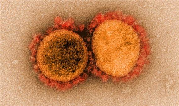 ویروس کرونا به سلول‌های قرمز خون آسیب می‌زند