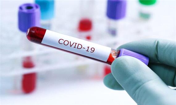 40 درصد مبتلایان به کووید-19 بی‌علامت هستند