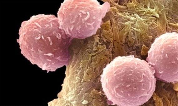 کشفی که مرگ تومورهای سرطانی را به دنبال دارد