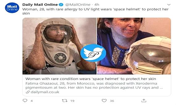 4گوشه دنیا/ زندگی عجیب دختر مراکشی با کلاه فضانوردی!