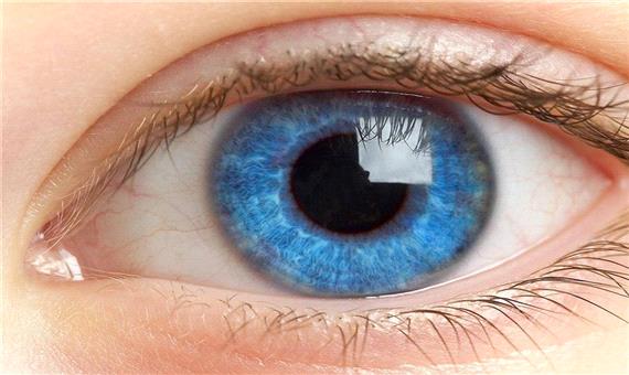 انواع علائم بیماری های چشمی