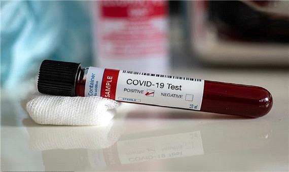 تشخیص مرگبار بودن ویروس کرونا با آزمایش خون