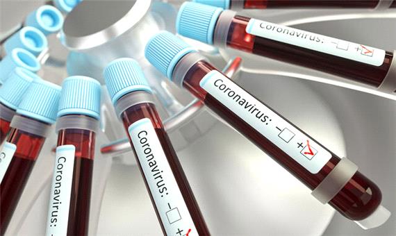 ویروس موجود در خون می‌تواند کووید-19 حاد را پیش‌بینی کند
