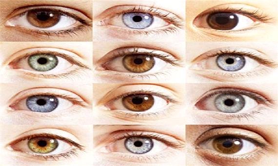 آیا می‌توان رنگ چشم ها را تغییر داد؟