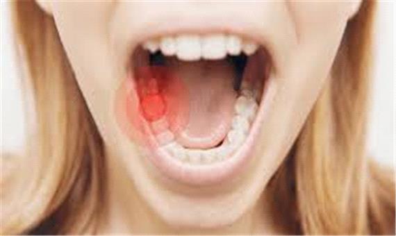 دندان‌درد را در خانه درمان کنید