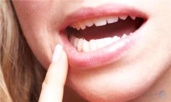 علت خُرد شدن ناگهانی دندان‌ها چیست؟
