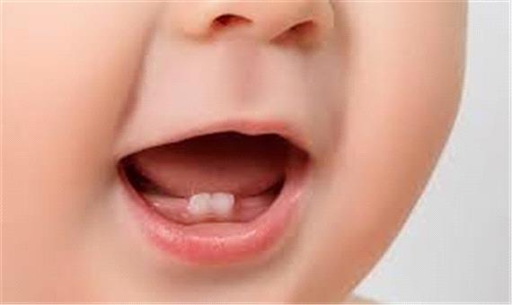 تاثیر سن مادر بر زمان رویش دندان فرزند
