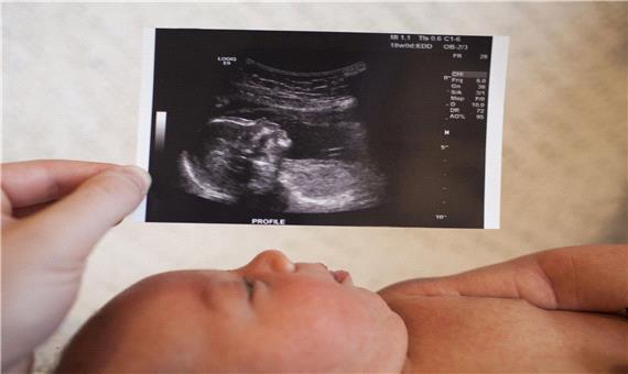 همه چیز درباره سونوگرافی بارداری