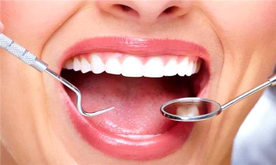 5 نکته مهم برای دندان های سالم