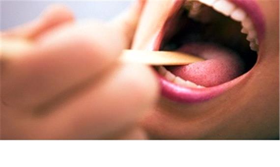 دهان چه رازهایی از سلامت شما را برملا می کند؟