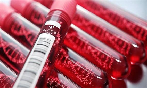 بررسی تاثیر گروه خونی افراد در خطر ابتلا به بیماری کووید-19