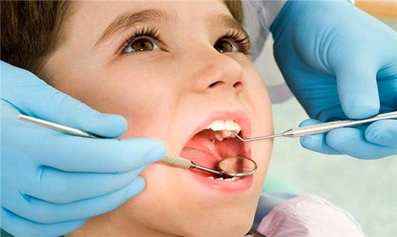 بیش از 80 درصد کودکان زیر شش سال پوسیدگی دندان دارند