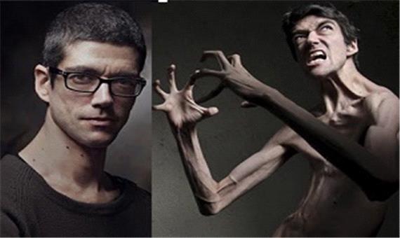 بیماری عجیب ترسناک ترین مرد قدبلند هالیوود + عکس