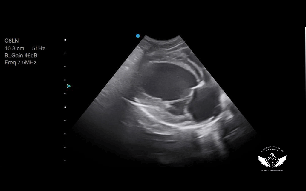 با مزه ترین سونوگرافی تاریخ