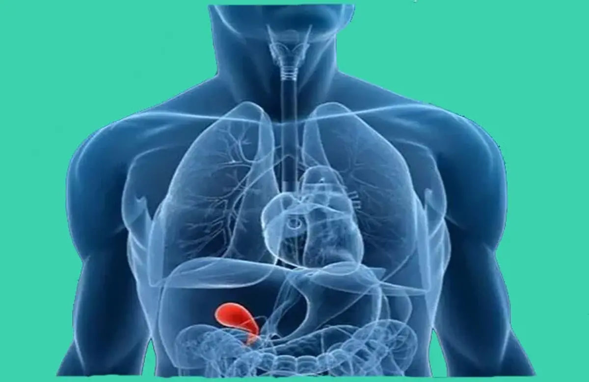 بهترین غذاهای برای سنگ کیسه صفرا سبزیجات است