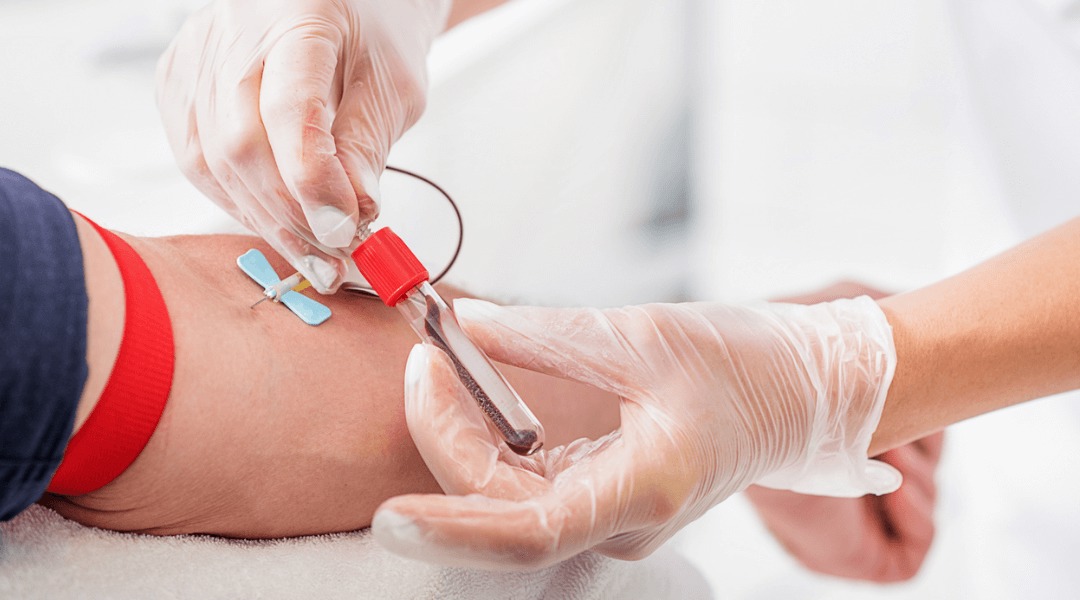 کم‌خونی یا چربی خون دارید؟ جواب آزمایش‌تان را در خانه و بدون هیچ مراجعه‌ای دریافت کنید