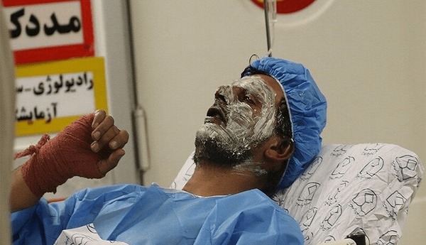 ۳۰۰ هزار ایرانی سالانه می سوزند