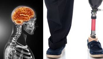 ماجرای مردی که از پزشکان خواست دو انگشتش را قطع کنند