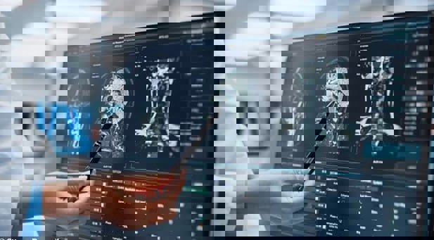 پنج نکته برتر برای کاهش ابتلا به بیماری زوال عقل