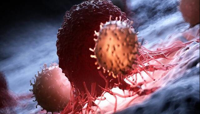 چرایی افزایش بروز سرطان‌ها؛ شایع‌ترین سرطان‌ها در ایران