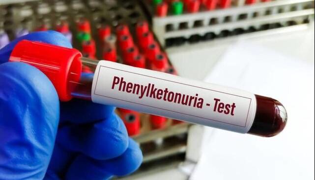 خبر خوش برای بیماران PKU؛ توزیع نان فاقد پروتئین رضوی در کشور