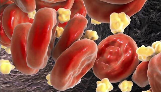 کلسترول بالا در جوانان؛ زنگ خطری که نباید نادیده گرفت