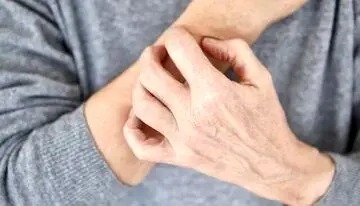 این نشانه ها یعنی بیماری پوستی