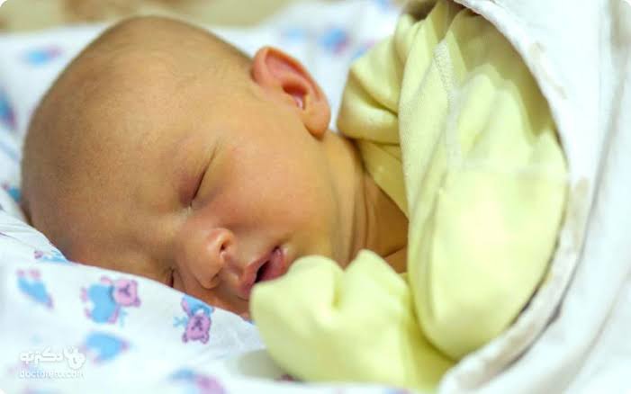 ۸۰ درصد نوزادان در هفته اول زندگی دچار زردی می‌شوند!