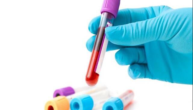 گفت و گو با مردی که خونش در ایران کمیاب‌تر از الماس است