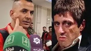 حامد لک: شبیه اسکار فیس شدم/ ویدئو