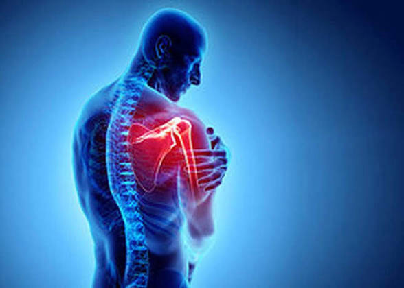 آیا جراحی تنها راه درمان شانه یخ‌زده است؟