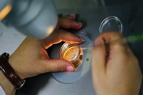 فریز تخمک برای همه زنان مناسب نیست