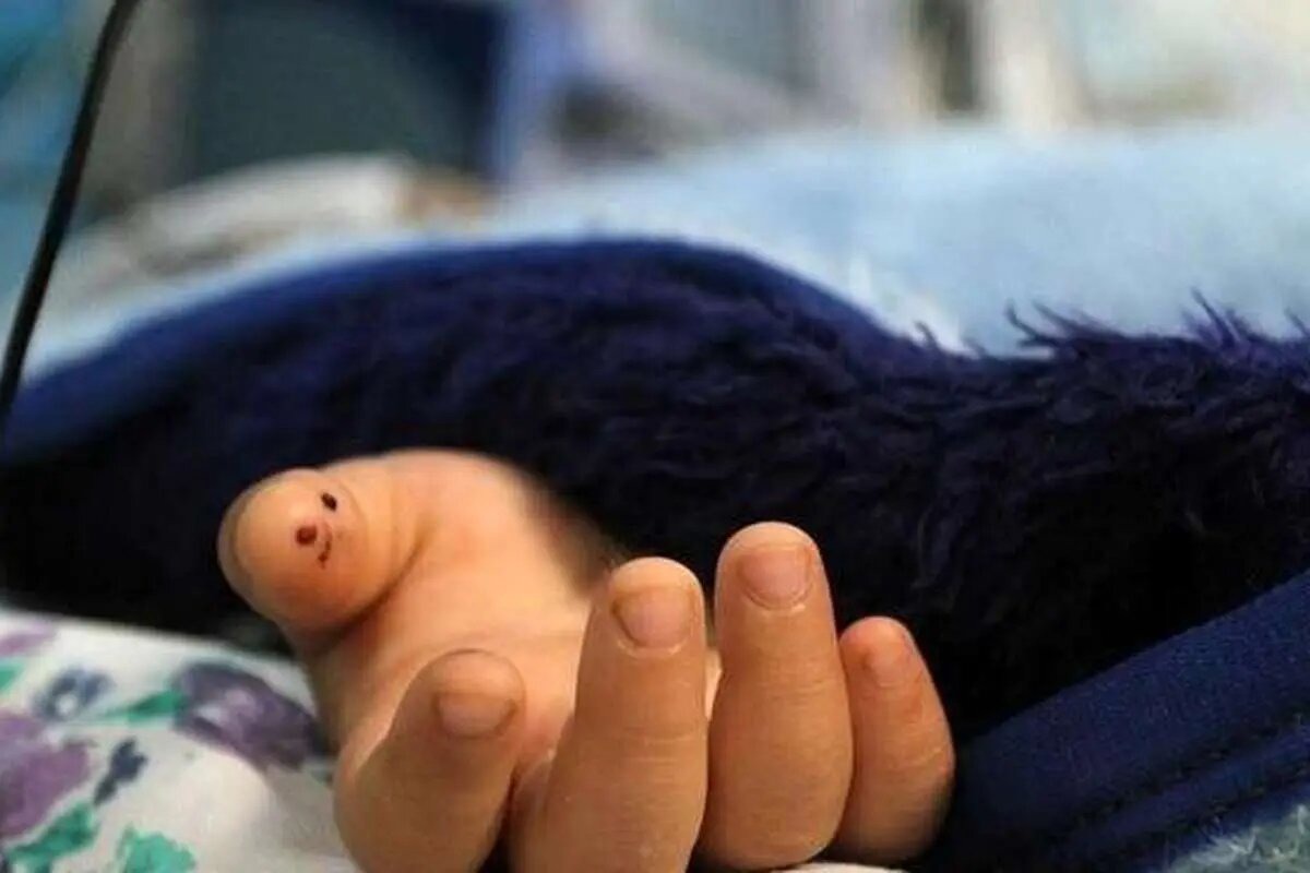 عقرب، جان دختربچه ۳ ساله را گرفت